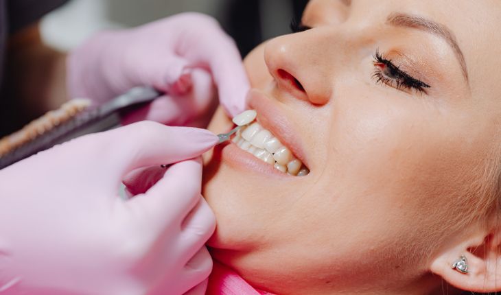 10 TIPS TO KEEP TEETH VENEERS LOOKING BRAND NEW