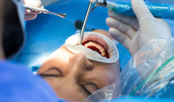 Service Provider of Oral And Maxillofacial Surgery in Ghaziabad, Uttar Pradesh, India.