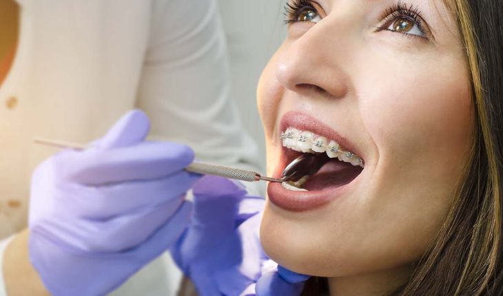 Service Provider of Orthodontic in Ghaziabad, Uttar Pradesh, India.