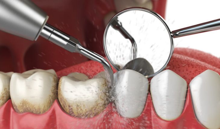 Service Provider of Periodontal Treatments in Ghaziabad, Uttar Pradesh, India.